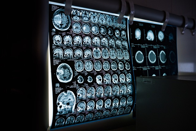 medical+ai+technology