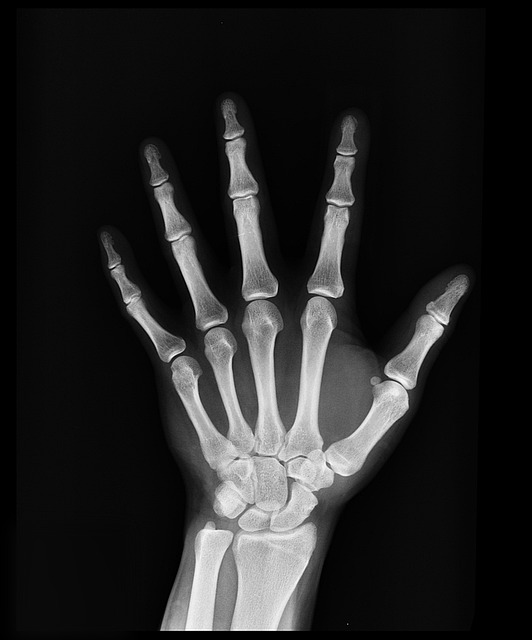 medical+dx+insurance
